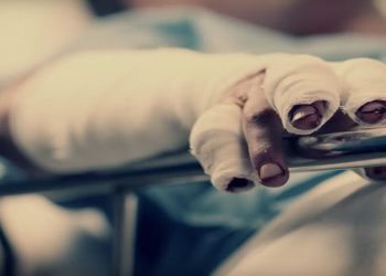 Van 572 personas quemadas con pólvora en el país