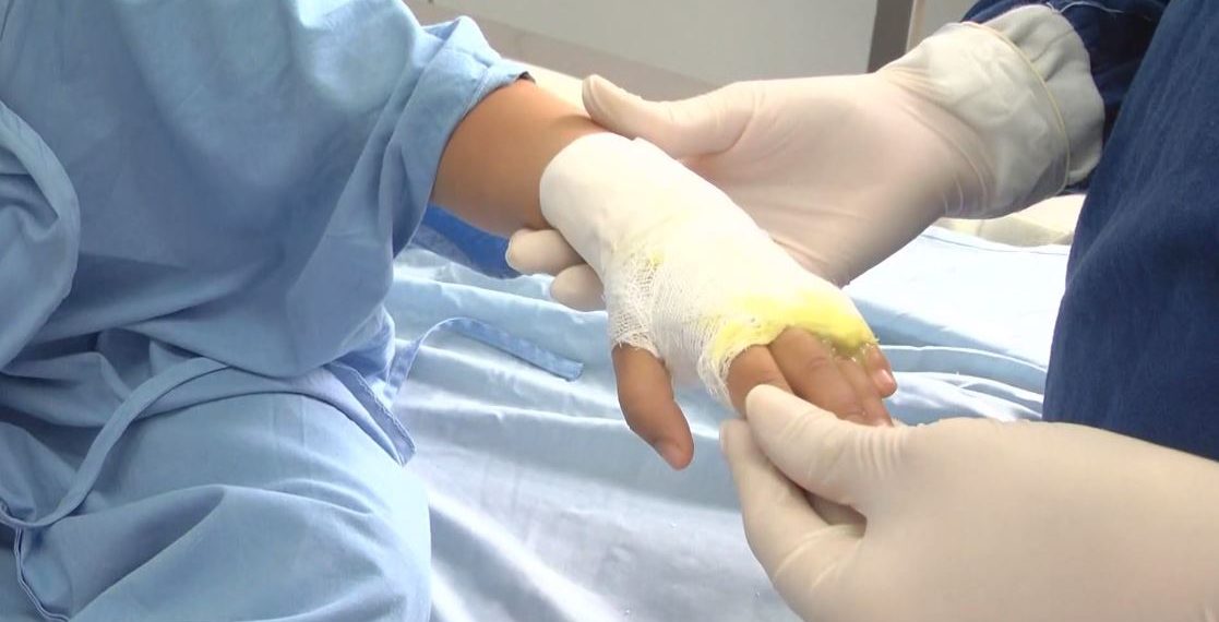 Van 466 lesionados por pólvora en Colombia