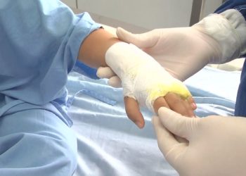 Van 466 lesionados por pólvora en Colombia