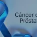 Cada día mueren 10 colombianos por cáncer de próstata