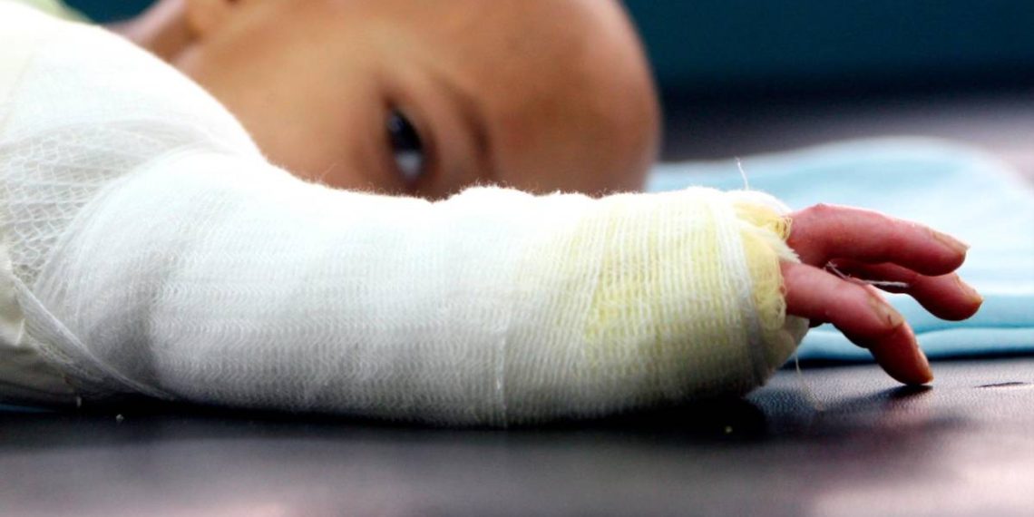 Aumentó el número de quemados con pólvora en Bucaramanga. Ya son cuatro los afectados