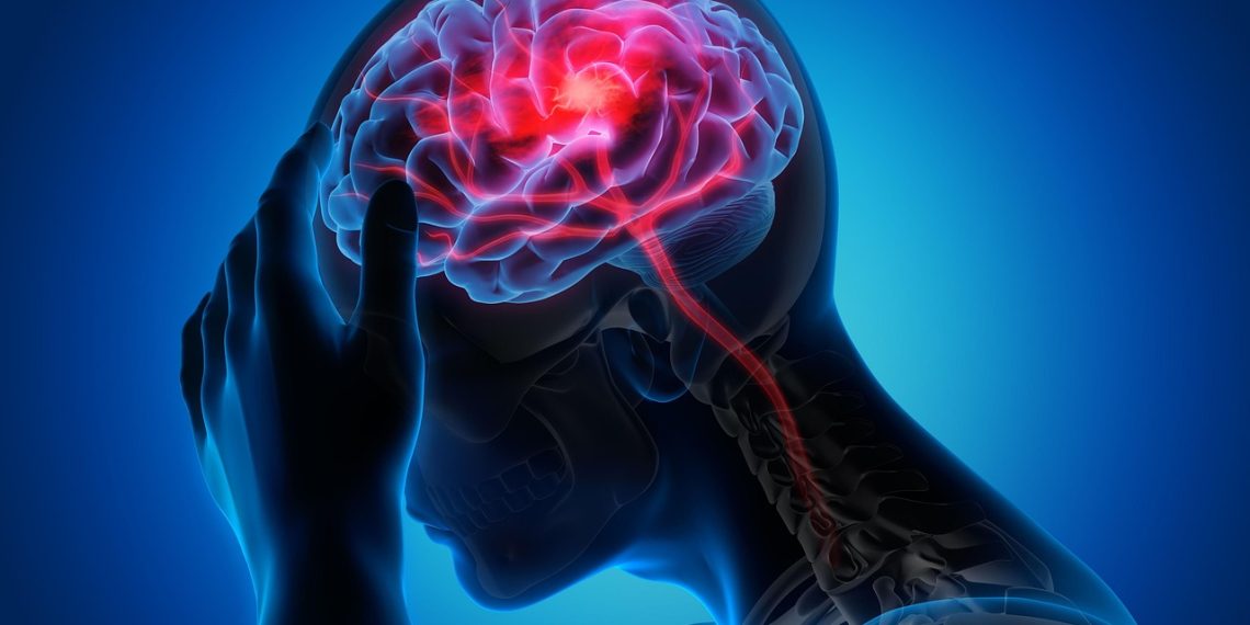 Migraña: una enfermedad invisible que exige atención pública