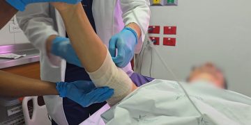 Primer lesionado por pólvora en Barrancabermeja: Alcaldía reitera llamado a la prevención y la corresponsabilidad ciudadana