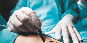 Alerta por centros estéticos irregulares tras denuncia de joven afectada en Bucaramanga